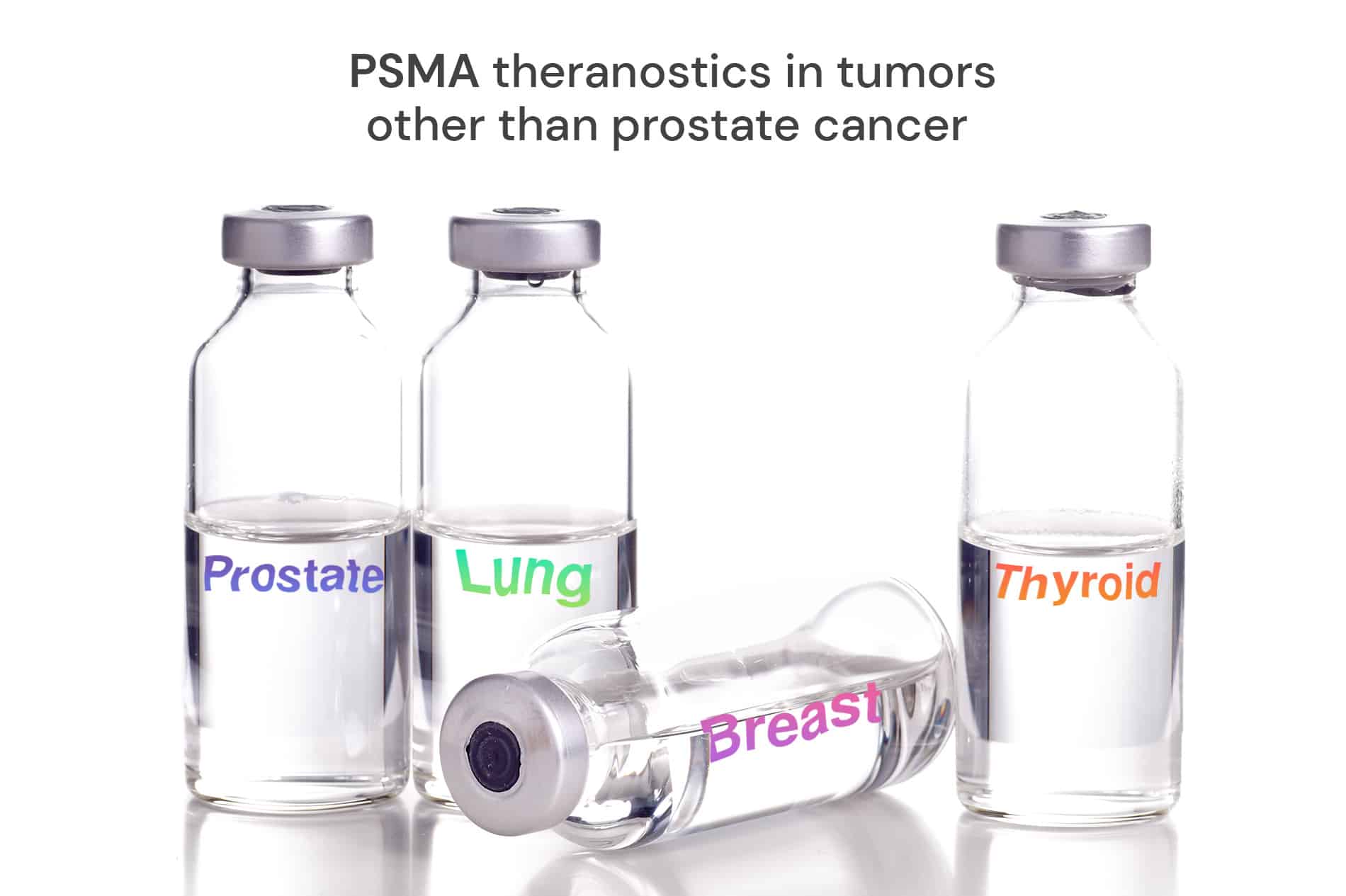 PSMA theranostics in tumors other than prostate cancer