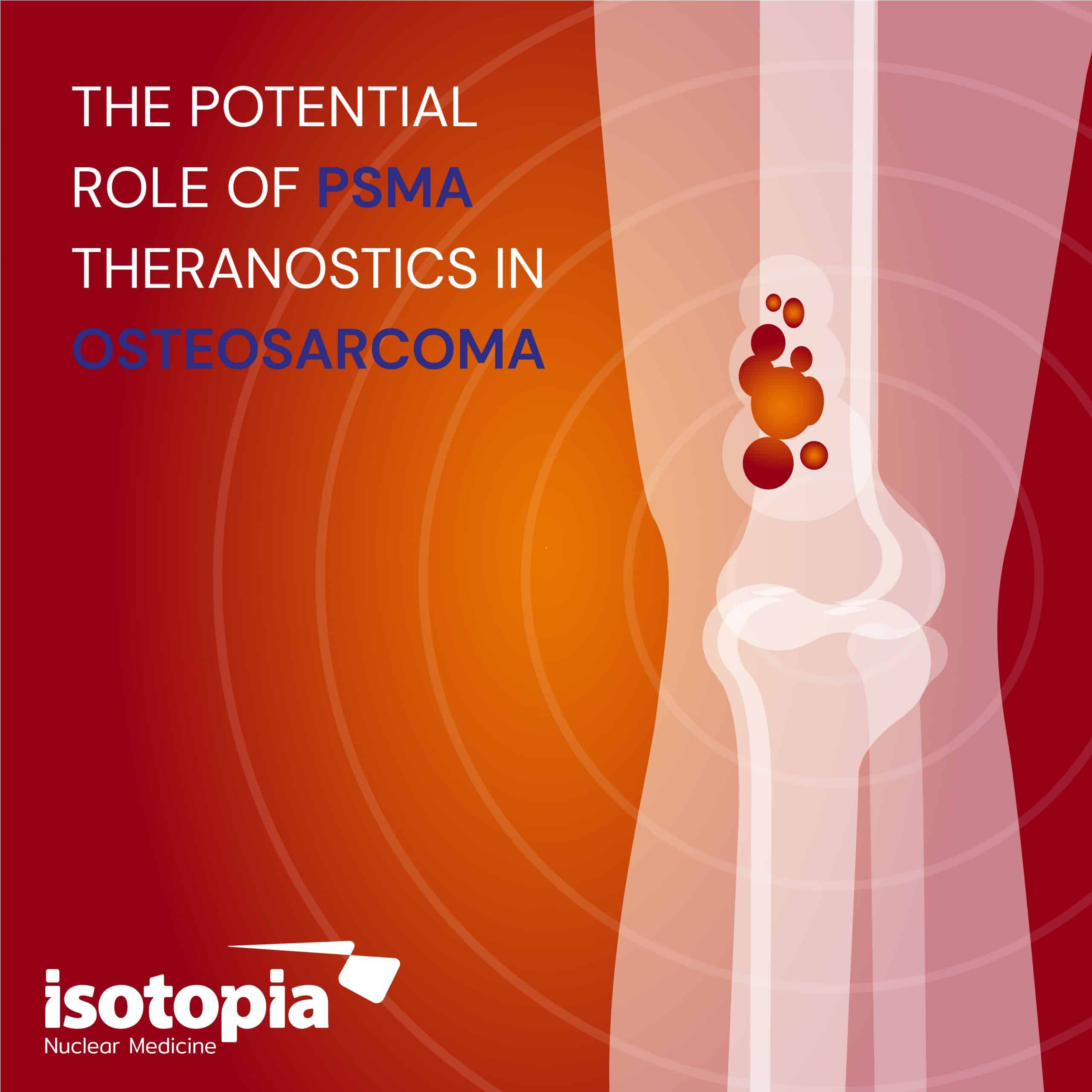 Is there a future for PSMA theranostics in Osteosarcoma?